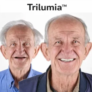 🦷 Ends Today: 70% OFF Trilumia™Custom-Fit Dentures