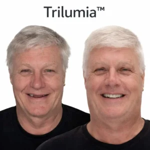 🦷 Ends Today: 70% OFF Trilumia™Custom-Fit Dentures
