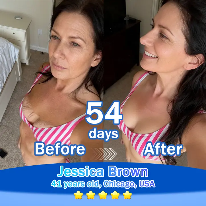 Trilumia® Synergistic Skin Tri-Complex Cream 💎(Copper Peptide+Growth Factors+Exosome)🏆Next-Generation Biotech for Wrinkle Repair💧