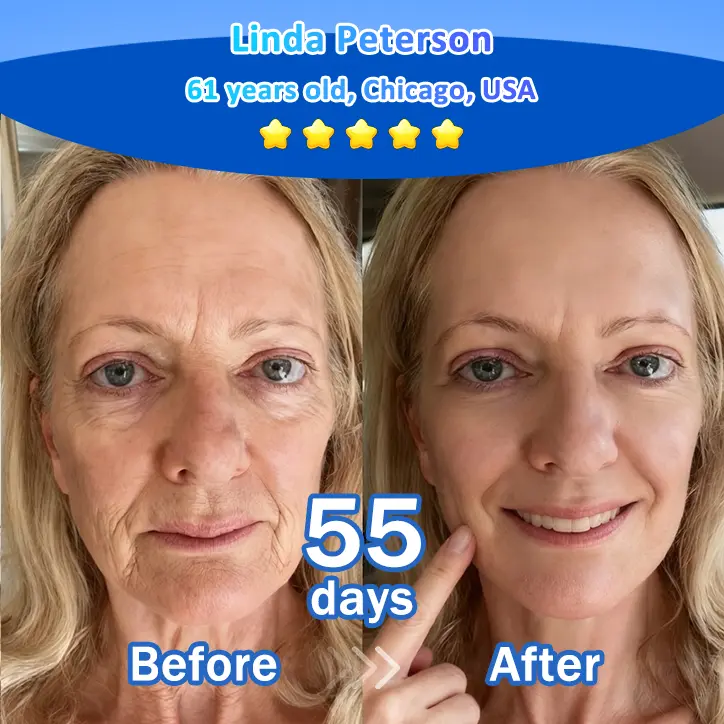 Trilumia® Synergistic Skin Tri-Complex Cream 💎(Copper Peptide+Growth Factors+Exosome)🏆Next-Generation Biotech for Wrinkle Repair💧