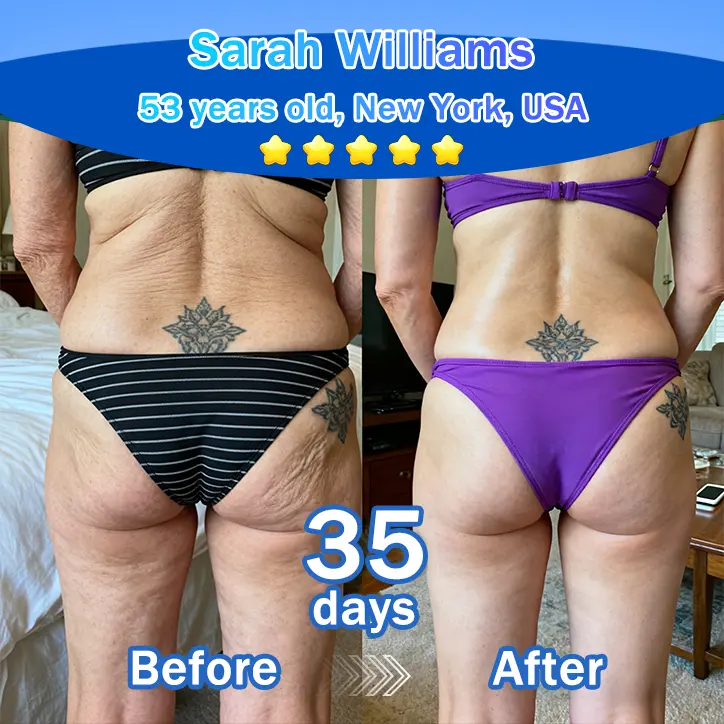 Trilumia® Synergistic Skin Tri-Complex Cream 💎(Copper Peptide+Growth Factors+Exosome)🏆Next-Generation Biotech for Wrinkle Repair💧