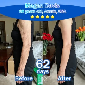 Trilumia® Synergistic Skin Tri-Complex Cream 💎(Copper Peptide+Growth Factors+Exosome)🏆Next-Generation Biotech for Wrinkle Repair💧