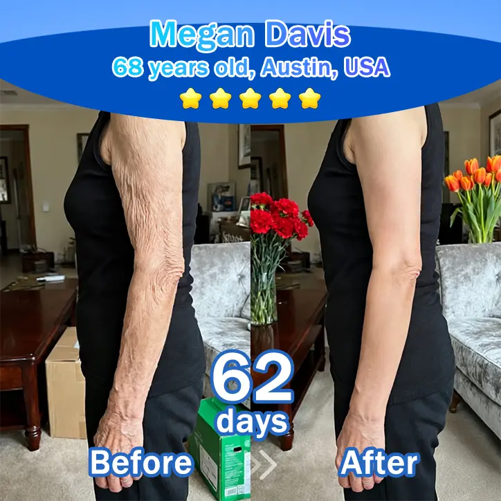 Trilumia® Synergistic Skin Tri-Complex Cream 💎(Copper Peptide+Growth Factors+Exosome)🏆Next-Generation Biotech for Wrinkle Repair💧